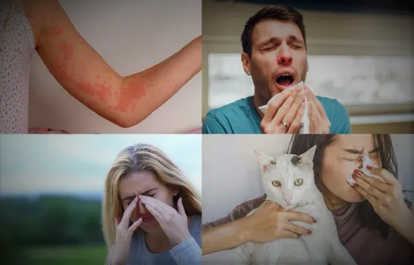 8 de julio: Día Mundial de la Alergia.